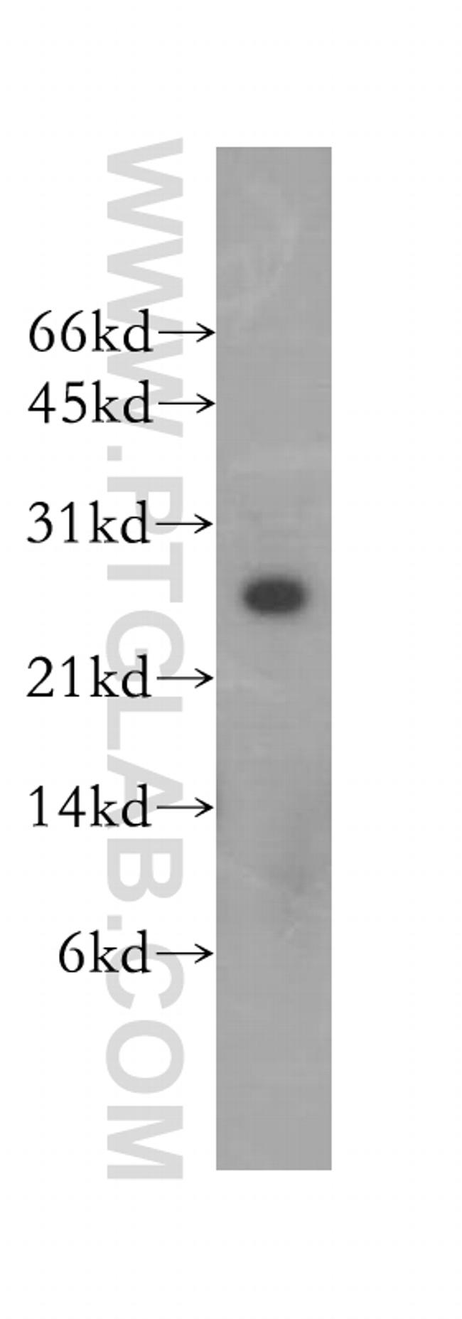 HEBP2 Antibody in Western Blot (WB)