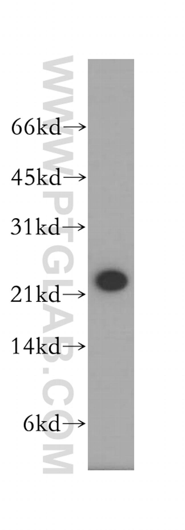 HEBP2 Antibody in Western Blot (WB)