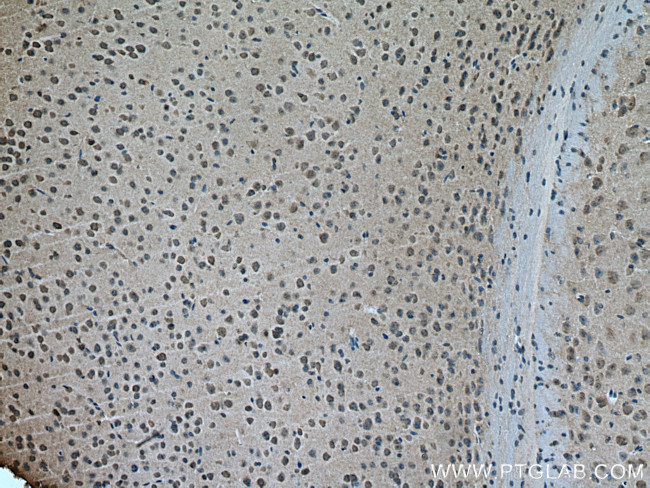 GABRA3 Antibody in Immunohistochemistry (Paraffin) (IHC (P))