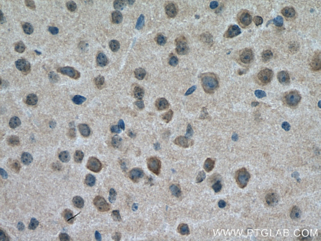 GABRA3 Antibody in Immunohistochemistry (Paraffin) (IHC (P))