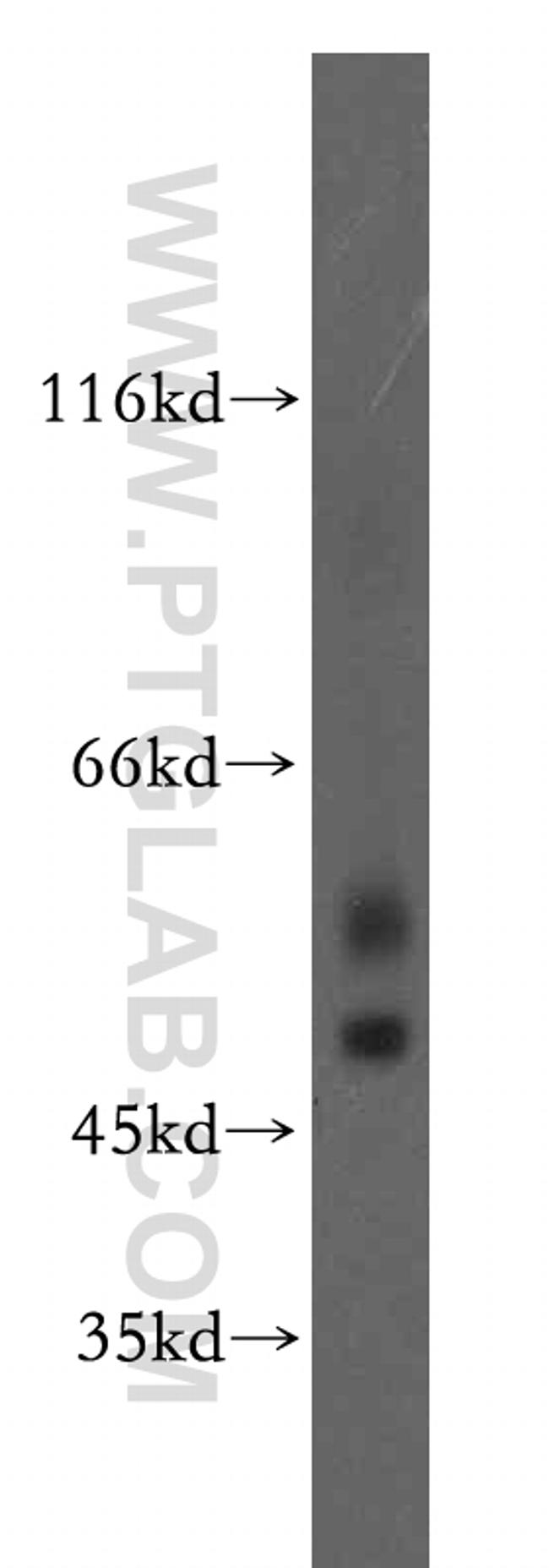 GABRA3 Antibody in Western Blot (WB)