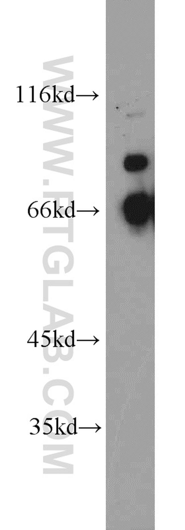 QSOX1 Antibody in Western Blot (WB)