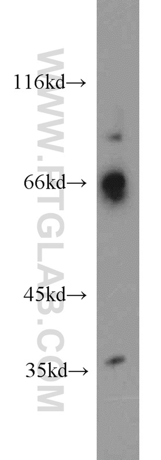 QSOX1 Antibody in Western Blot (WB)