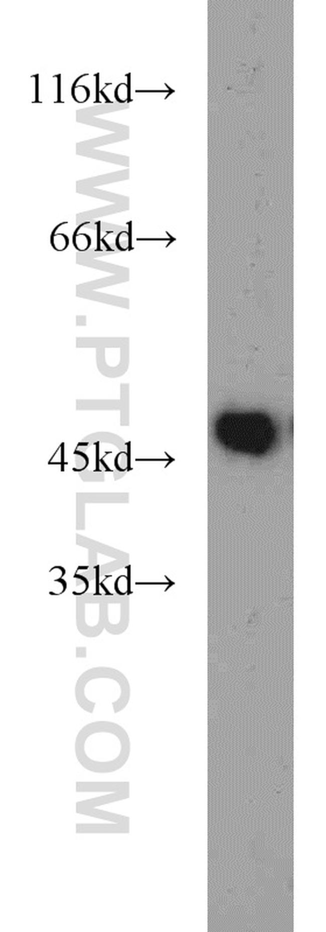 ZNF238 Antibody in Western Blot (WB)