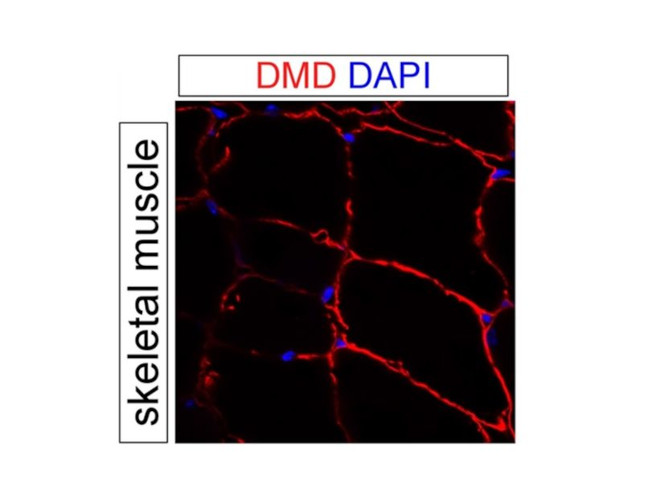 Dystrophin Antibody in Immunohistochemistry (PFA fixed) (IHC (PFA))