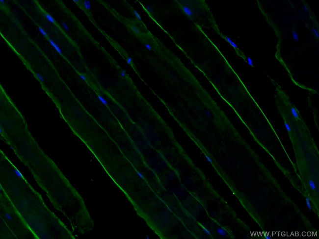 Dystrophin Antibody in Immunohistochemistry (PFA fixed) (IHC (PFA))