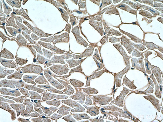 Dystrophin Antibody in Immunohistochemistry (Paraffin) (IHC (P))