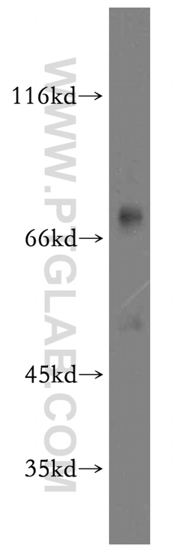 Dystrophin Antibody in Western Blot (WB)