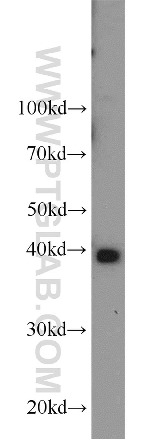 PPID Antibody in Western Blot (WB)