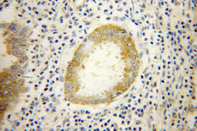 PPID Antibody in Immunohistochemistry (Paraffin) (IHC (P))