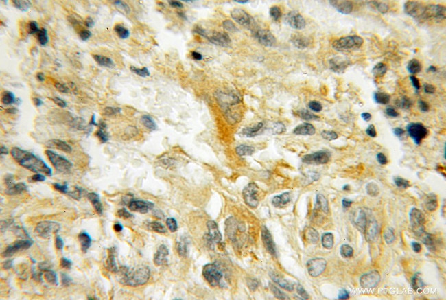 PMP2 Antibody in Immunohistochemistry (Paraffin) (IHC (P))