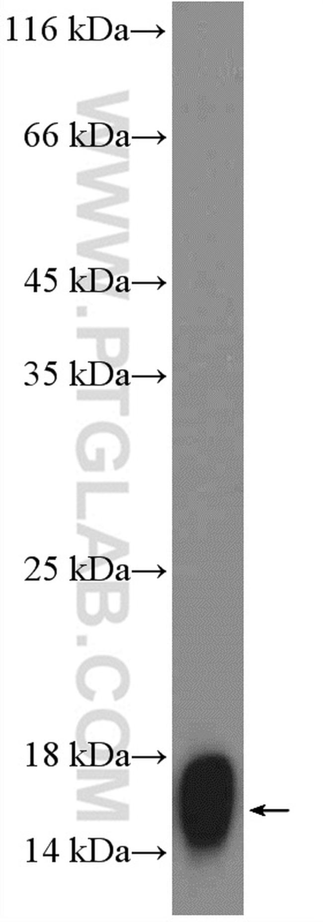 PMP2 Antibody in Western Blot (WB)