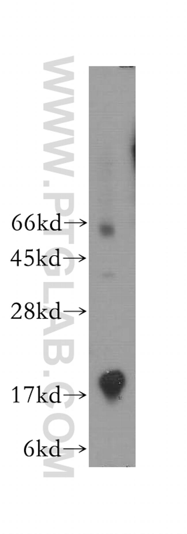 PMP2 Antibody in Western Blot (WB)