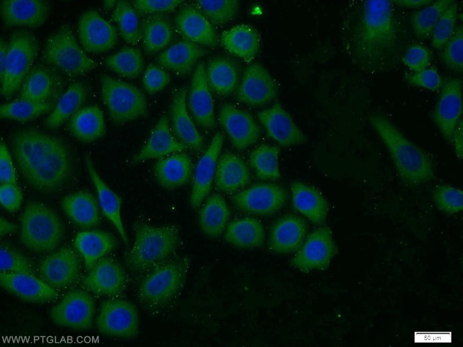 TROVE2 Antibody in Immunocytochemistry (ICC/IF)