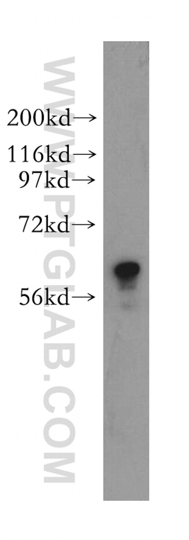 TROVE2 Antibody in Western Blot (WB)