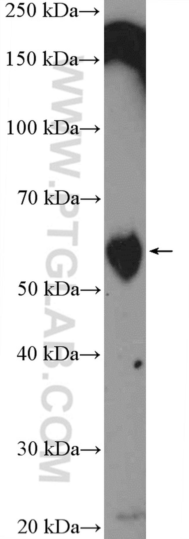 TROVE2 Antibody in Western Blot (WB)