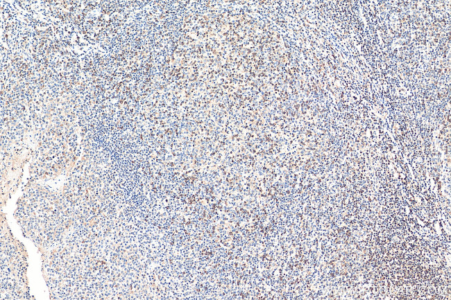 SLP76 Antibody in Immunohistochemistry (Paraffin) (IHC (P))
