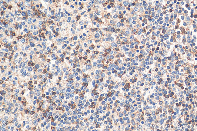 SLP76 Antibody in Immunohistochemistry (Paraffin) (IHC (P))