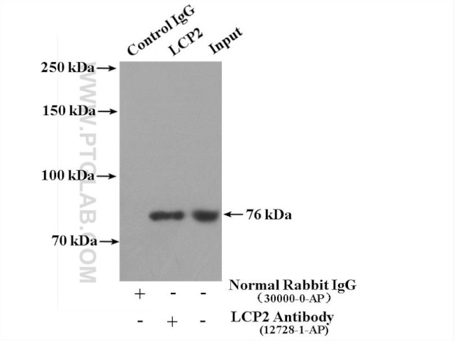 SLP76 Antibody in Immunoprecipitation (IP)