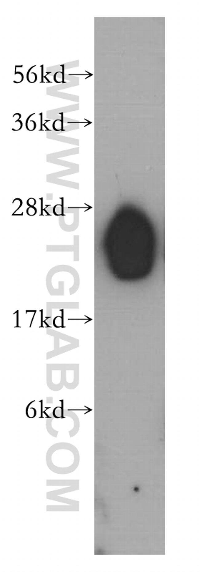 LIN7B Antibody in Western Blot (WB)