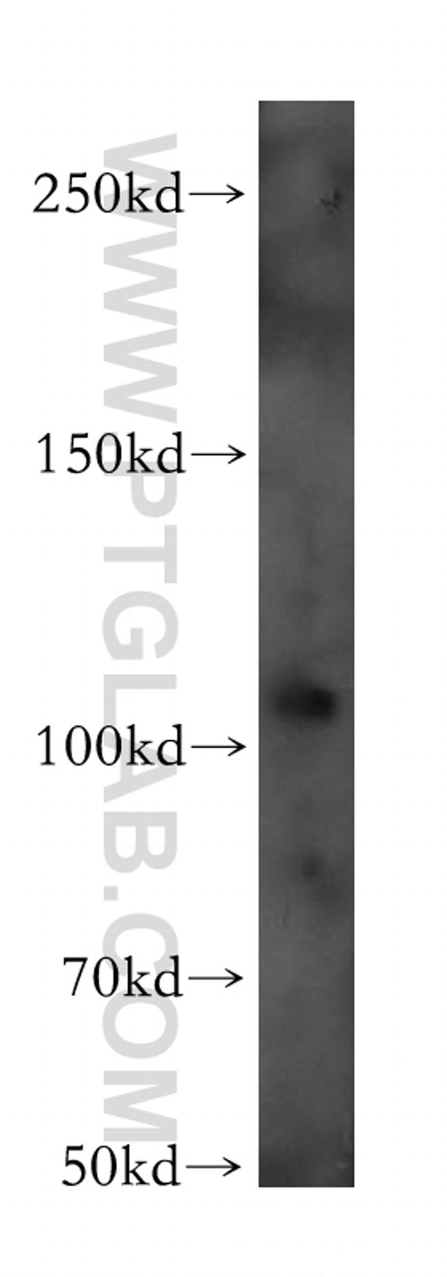 EIF3C Antibody in Western Blot (WB)