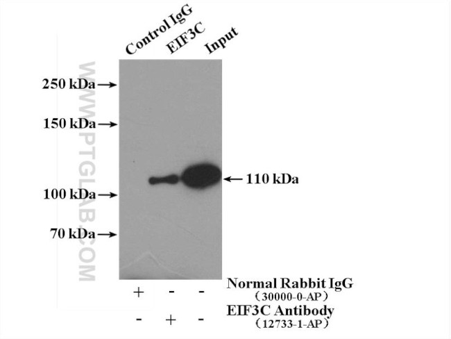 EIF3C Antibody in Immunoprecipitation (IP)