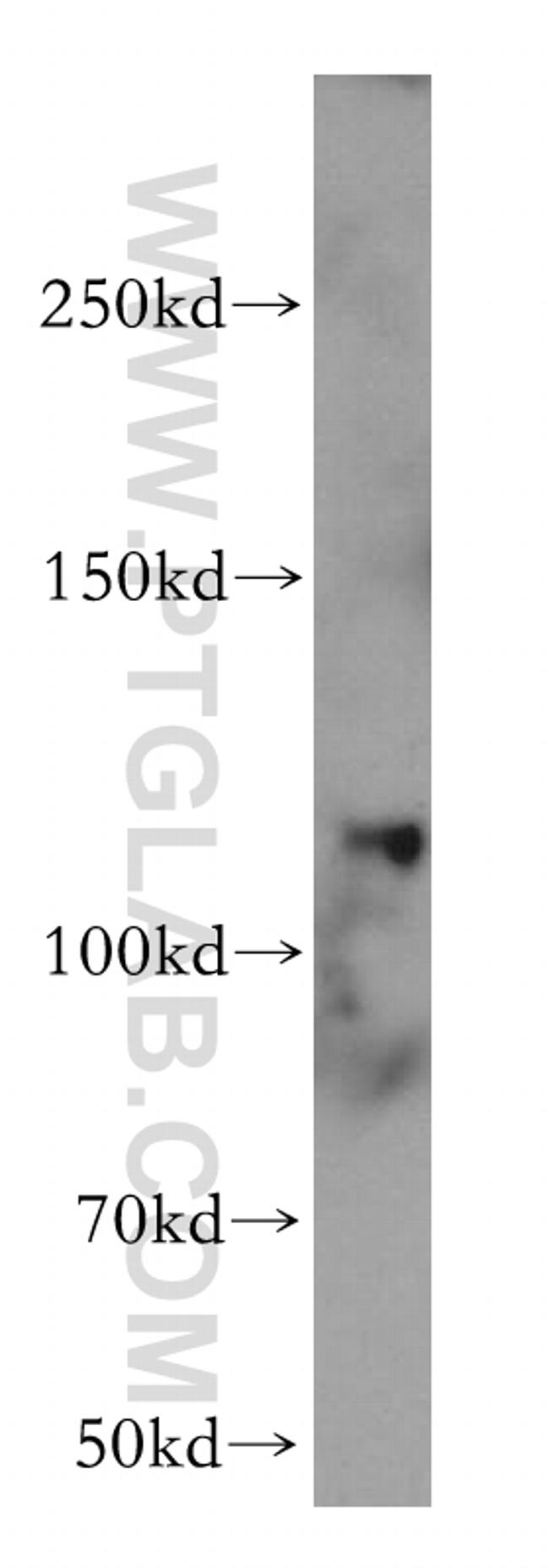 EIF3C Antibody in Western Blot (WB)