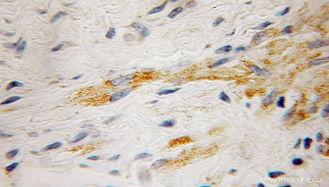 RabGEF1 Antibody in Immunohistochemistry (Paraffin) (IHC (P))