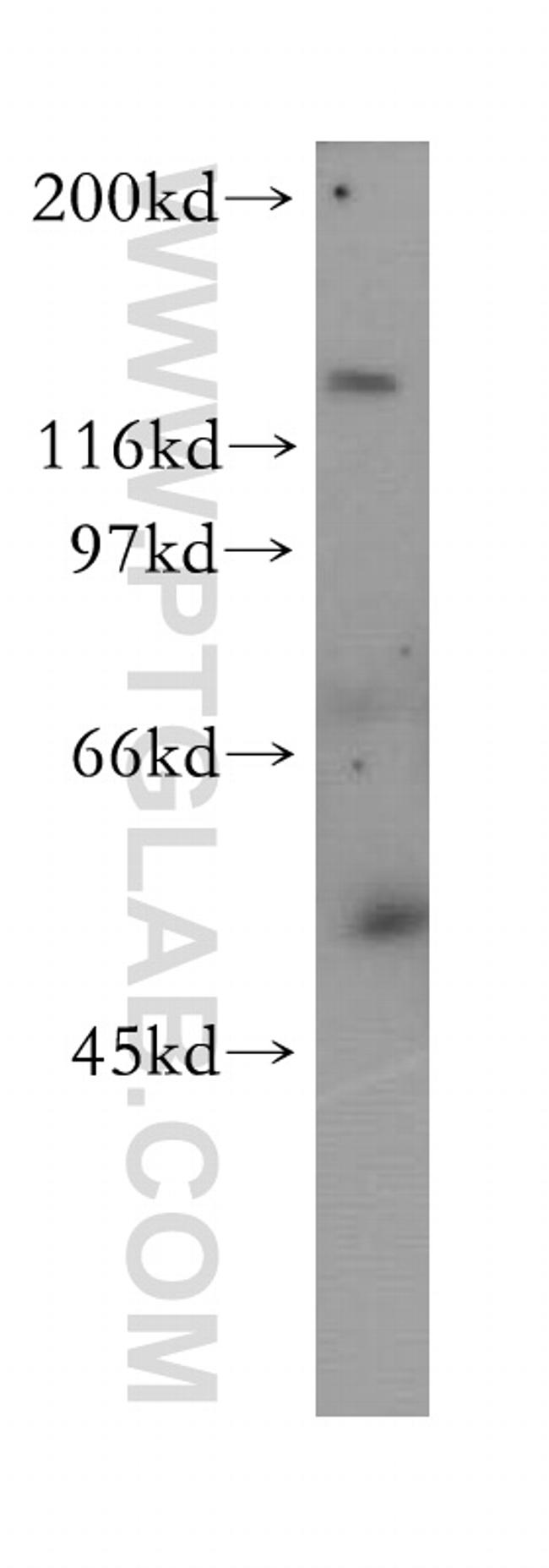 RabGEF1 Antibody in Western Blot (WB)