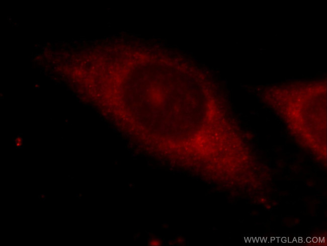 ZFP36 Antibody in Immunocytochemistry (ICC/IF)