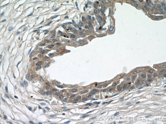 ZFP36 Antibody in Immunohistochemistry (Paraffin) (IHC (P))