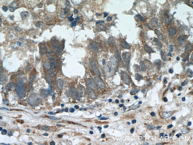 ZFP36 Antibody in Immunohistochemistry (Paraffin) (IHC (P))