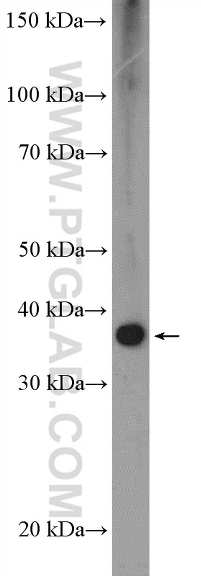 ZFP36 Antibody in Western Blot (WB)