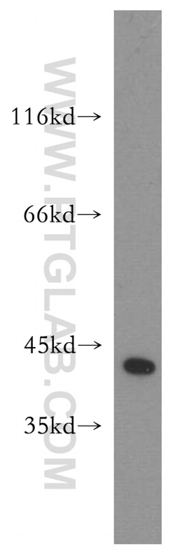 ZFP36 Antibody in Western Blot (WB)