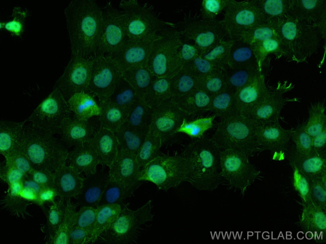 NET1 Antibody in Immunocytochemistry (ICC/IF)