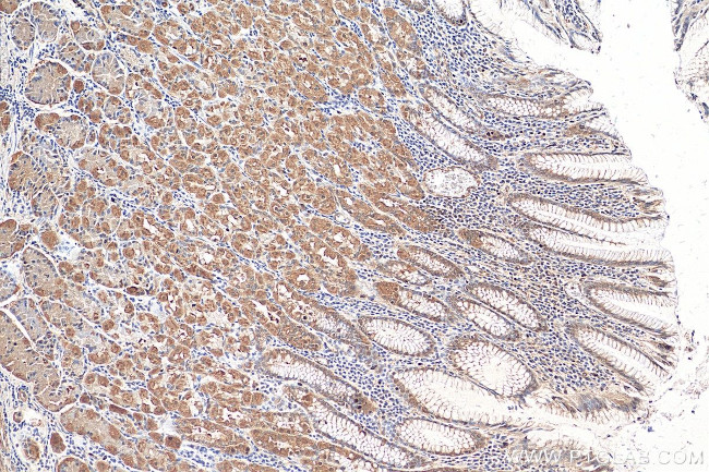 NET1 Antibody in Immunohistochemistry (Paraffin) (IHC (P))