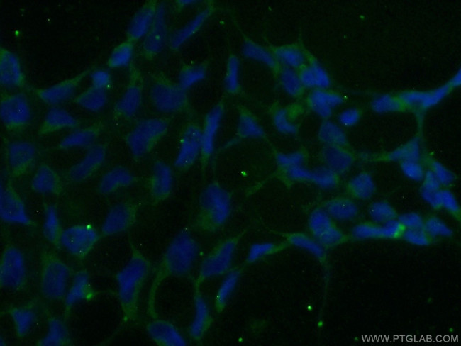 ADAMTS1 Antibody in Immunocytochemistry (ICC/IF)