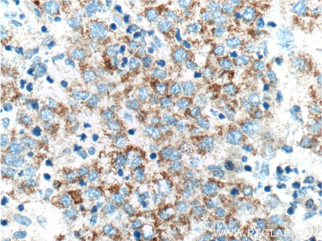 ADAMTS1 Antibody in Immunohistochemistry (Paraffin) (IHC (P))