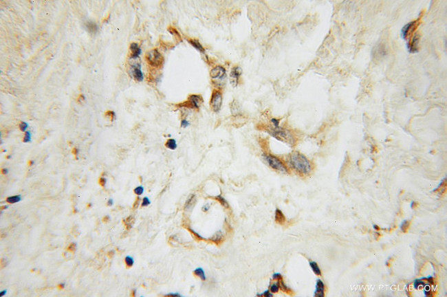 SEC5/EXOC2 Antibody in Immunohistochemistry (Paraffin) (IHC (P))