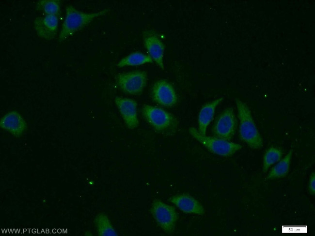 DPP8 Antibody in Immunocytochemistry (ICC/IF)