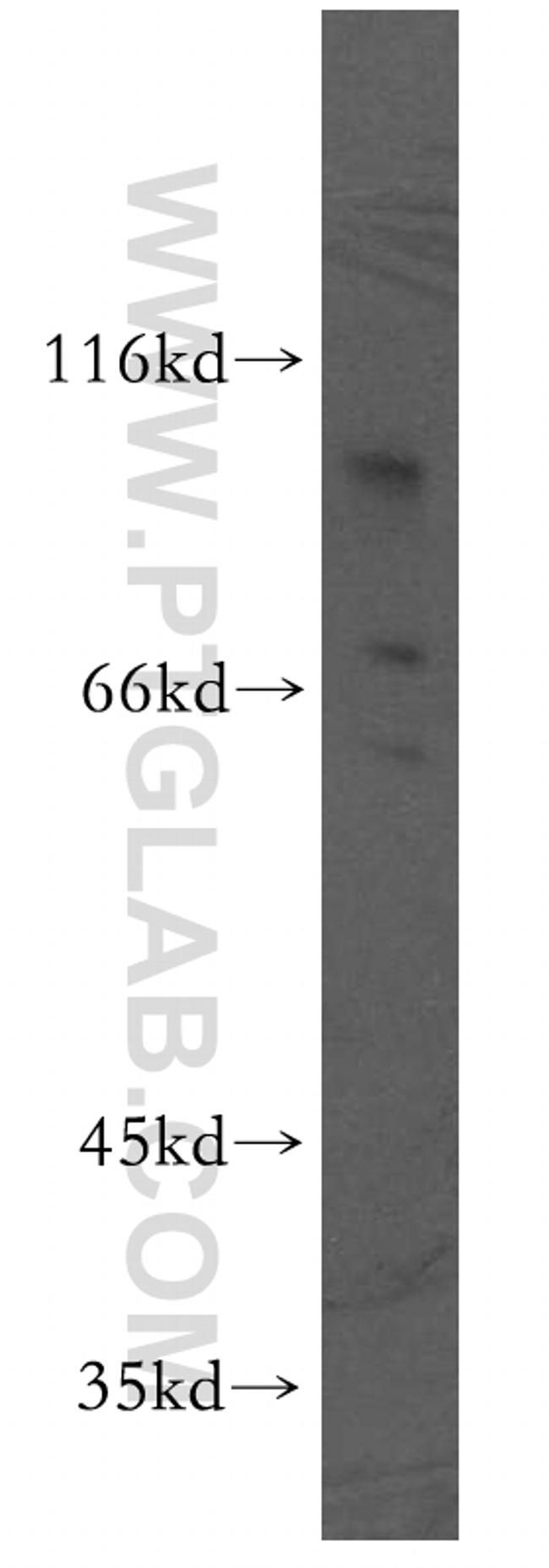 DPP8 Antibody in Western Blot (WB)