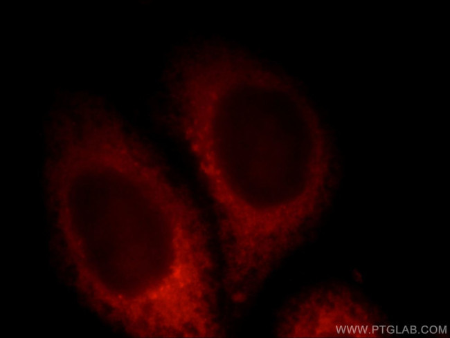 PDE12 Antibody in Immunocytochemistry (ICC/IF)