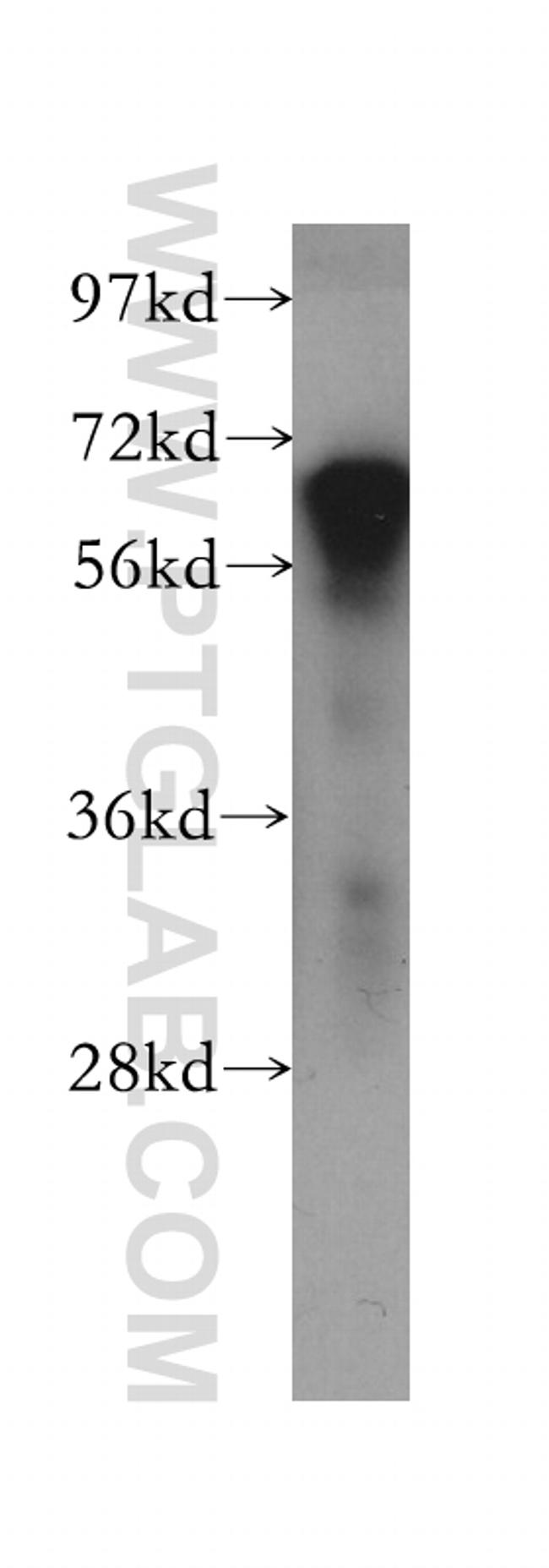 PDE12 Antibody in Western Blot (WB)