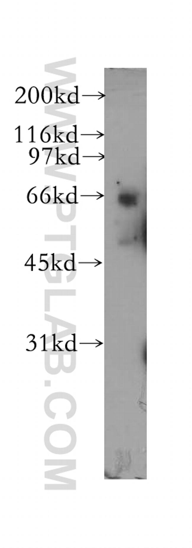 PDE12 Antibody in Western Blot (WB)