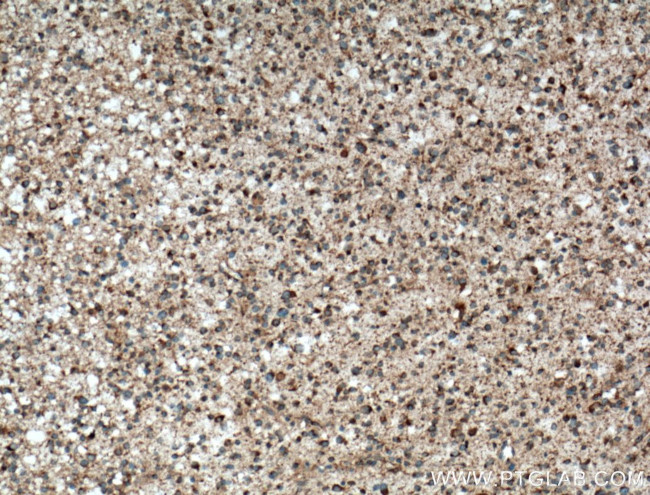 KIF1C Antibody in Immunohistochemistry (Paraffin) (IHC (P))