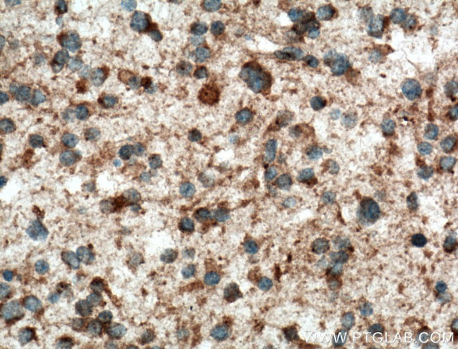 KIF1C Antibody in Immunohistochemistry (Paraffin) (IHC (P))