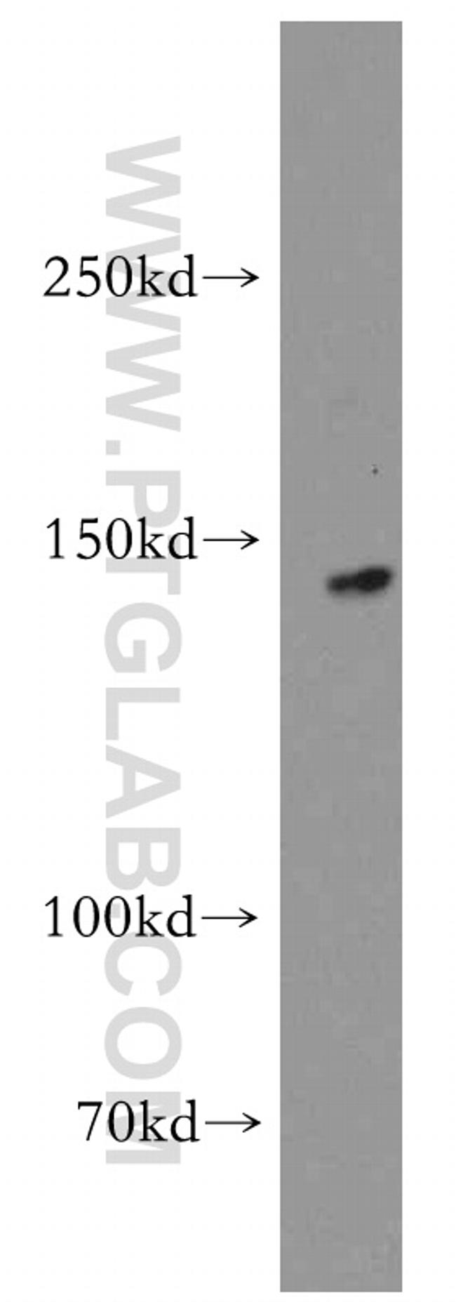 KIF1C Antibody in Western Blot (WB)