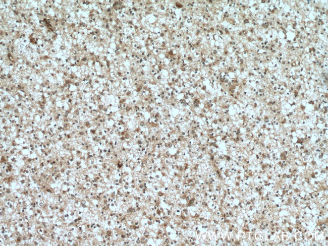 ELMOD1 Antibody in Immunohistochemistry (Paraffin) (IHC (P))