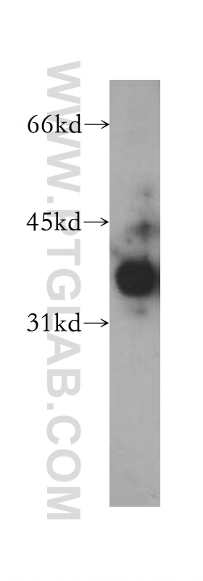 ELMOD1 Antibody in Western Blot (WB)