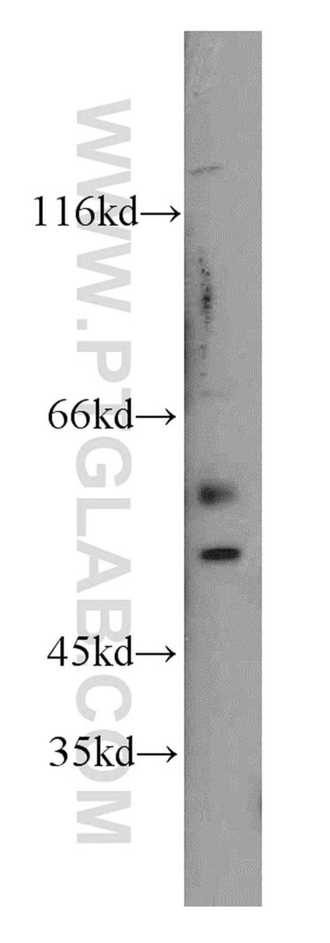 FOXG1 Antibody in Western Blot (WB)